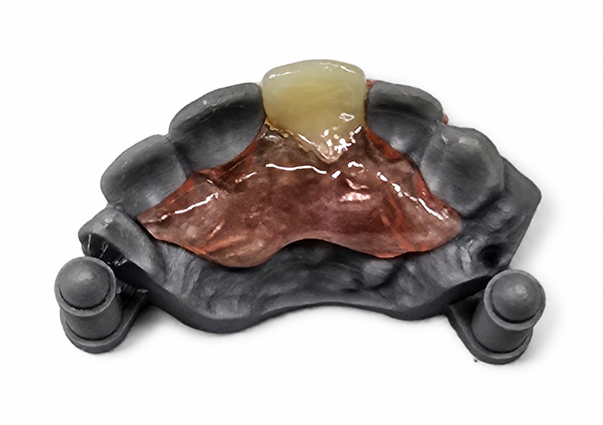Single-Tooth Flexible Flipper