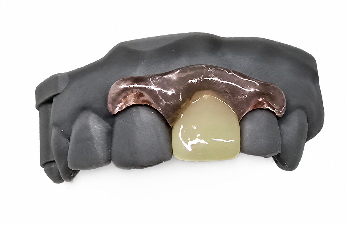 Single-Tooth Flexible Flipper