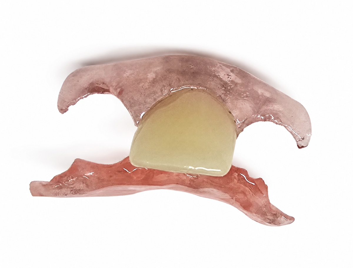 Single-Tooth Flexible Flipper