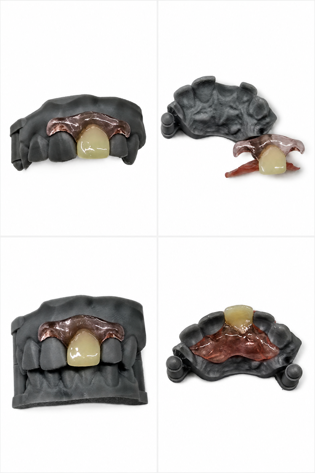 Single-Tooth Flexible Flipper