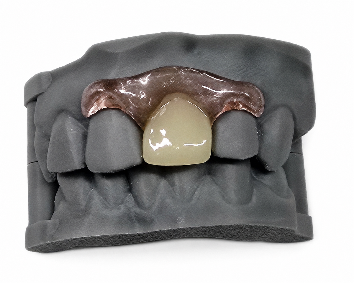 Single-Tooth Flexible Flipper